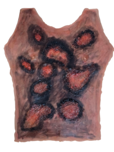 Brulure thorax